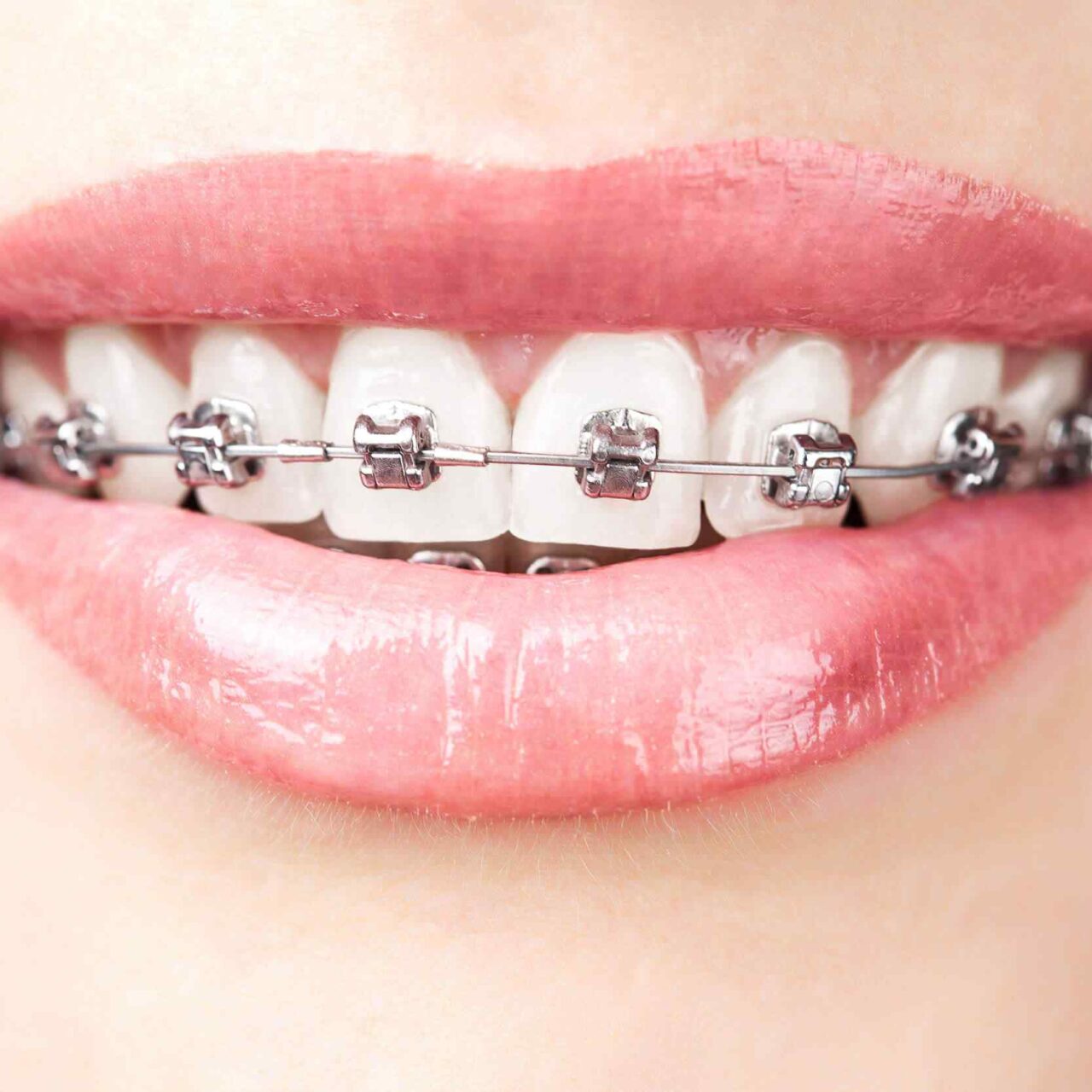 https://sanadentalclinic1.com/wp-content/uploads/2020/01/post-03-1280x1280.jpg