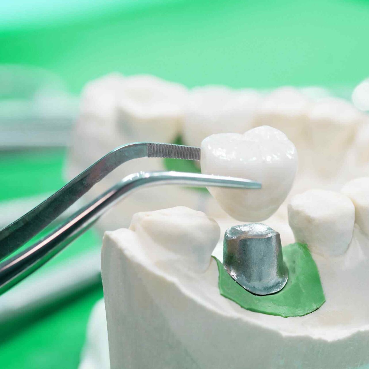https://sanadentalclinic1.com/wp-content/uploads/2020/01/post-28-1280x1280.jpg