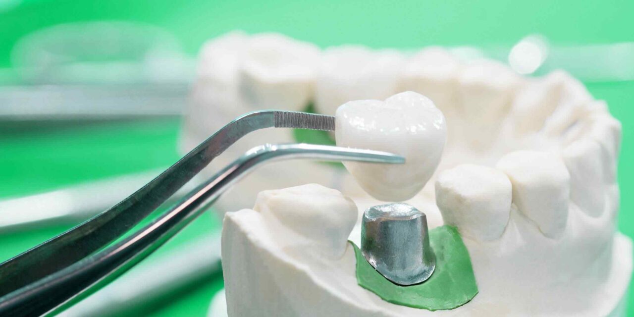 https://sanadentalclinic1.com/wp-content/uploads/2020/01/post-28-1280x640.jpg