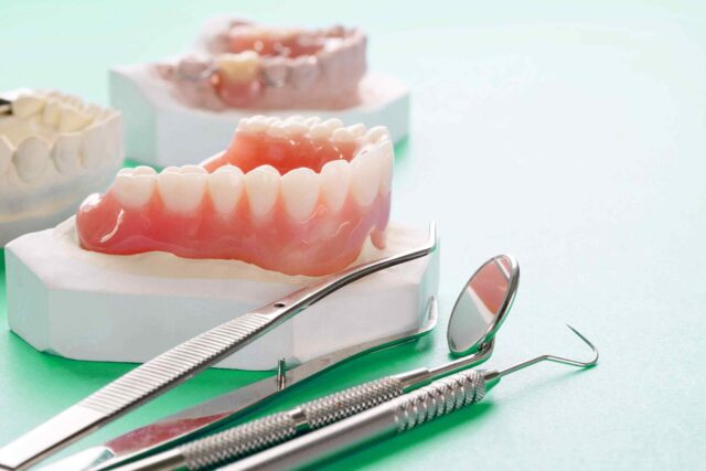 https://sanadentalclinic1.com/wp-content/uploads/2020/01/post-30-640x427.jpg