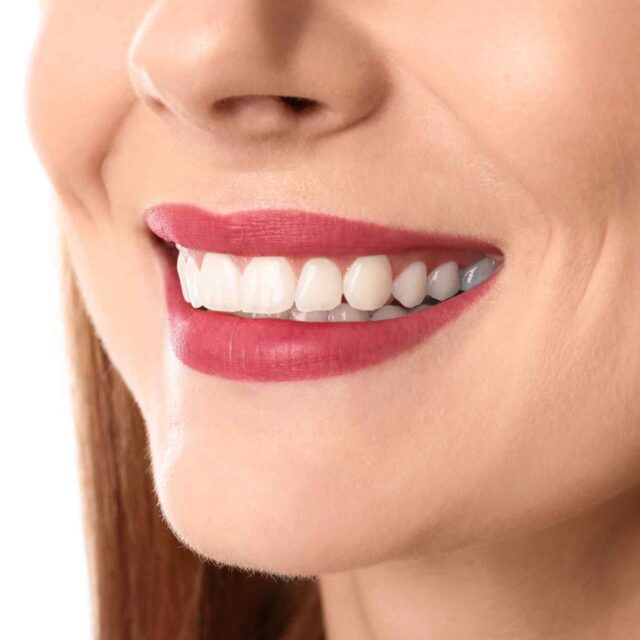https://sanadentalclinic1.com/wp-content/uploads/2020/03/service_whitening-640x640.jpg
